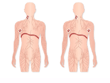 Illustration of nodes